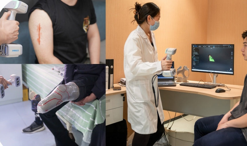 Prosthetics 3D scanning