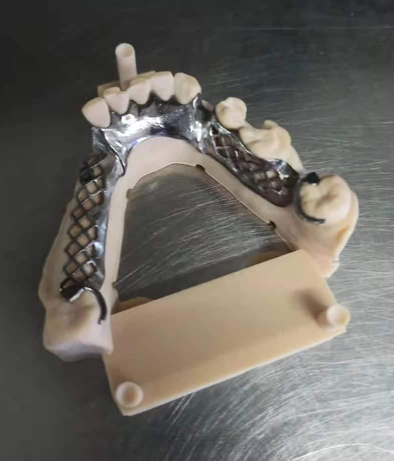 Dental Model maybe by Printer